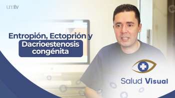 10 Entropión, Ectoprión y Dacrioestenosis congénita | Salud Visual